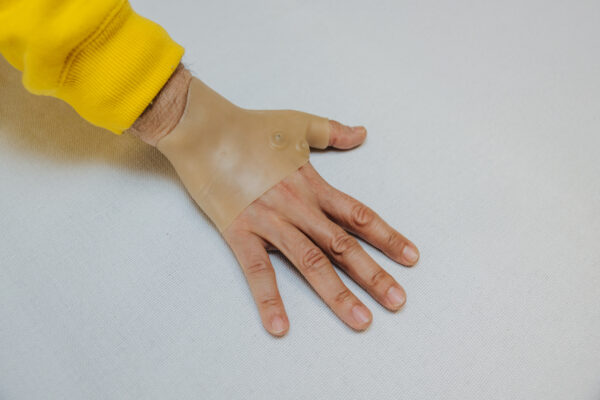 Guante terapia magnetica para mano con artritis y tendinitis - Imagen 2